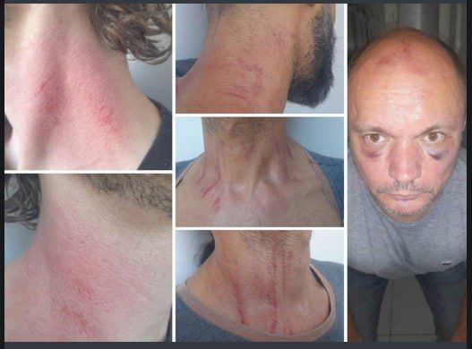 Обстановка в стане ВСУ: Отсутствие пополнения приводит в ярость идейных нацистов и нацисток, а так же "успехи" Украины в возвращении в строй дезертиров Обстановка в стане ВСУ: Отсутствие пополнения приводит в ярость идейных нацистов и нацисток, а так же "успехи" Украины в возвращении в строй дезертиров