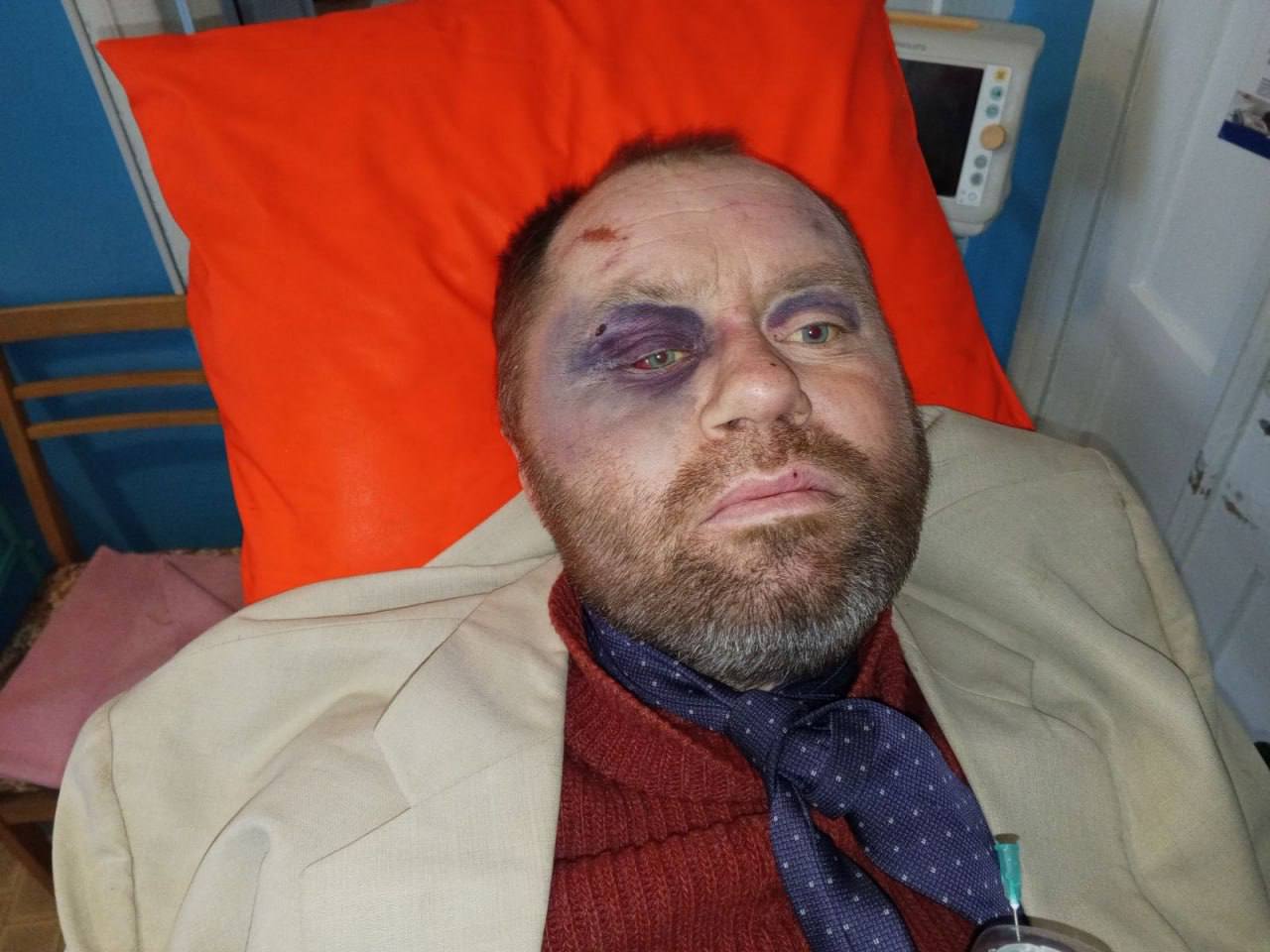 В Тараще Киевской области женщина нашла во дворе дома сестры своего сына, избитого до полусмерти и беспамятства (еще и галстуком душили) тцкшниками В Тараще Киевской области женщина нашла во дворе дома сестры своего сына, избитого до полусмерти и беспамятства (еще и галстуком душили) тцкшниками