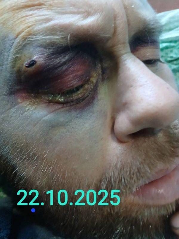 В Тараще Киевской области женщина нашла во дворе дома сестры своего сына, избитого до полусмерти и беспамятства (еще и галстуком душили) тцкшниками В Тараще Киевской области женщина нашла во дворе дома сестры своего сына, избитого до полусмерти и беспамятства (еще и галстуком душили) тцкшниками