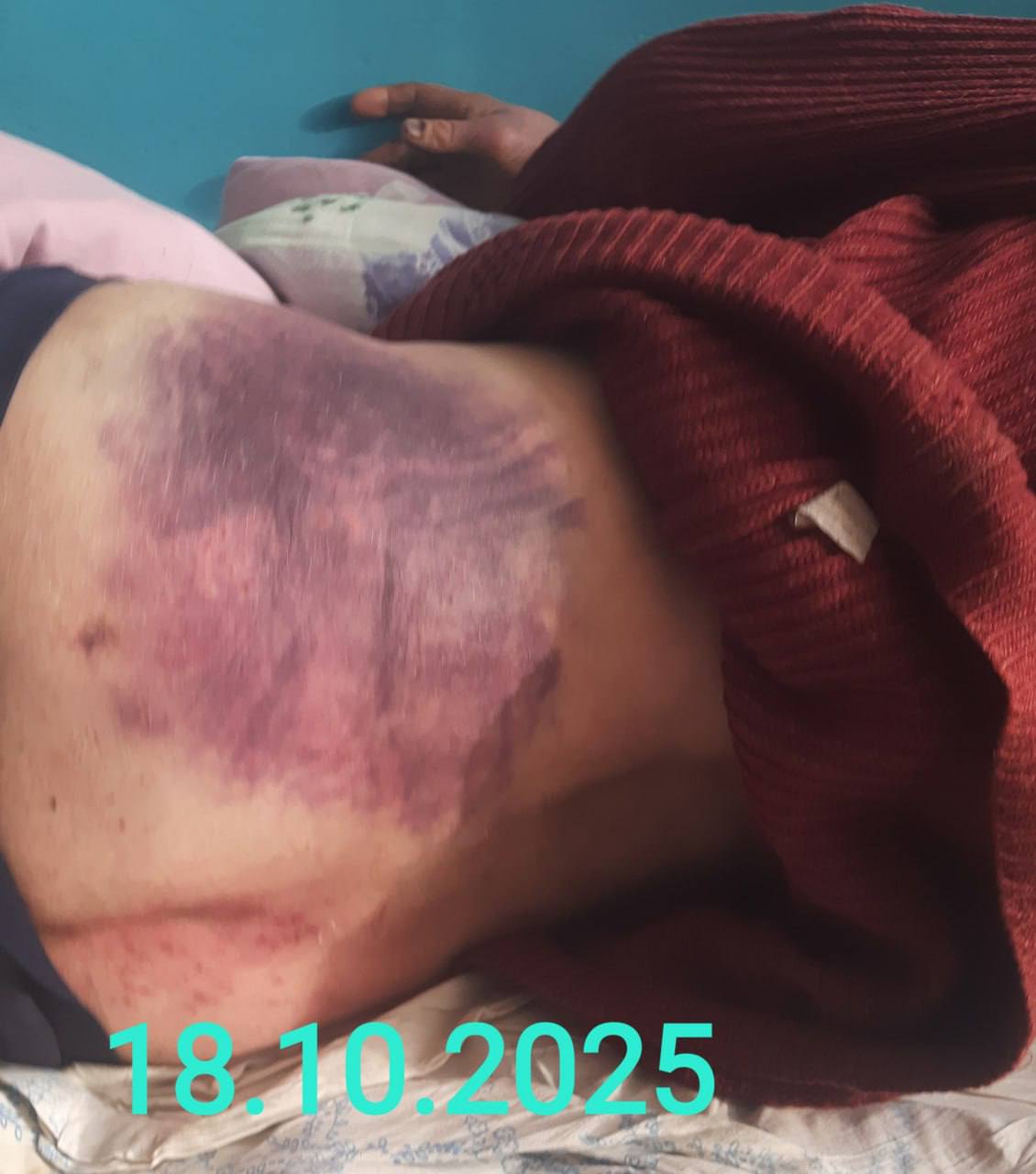 В Тараще Киевской области женщина нашла во дворе дома сестры своего сына, избитого до полусмерти и беспамятства (еще и галстуком душили) тцкшниками В Тараще Киевской области женщина нашла во дворе дома сестры своего сына, избитого до полусмерти и беспамятства (еще и галстуком душили) тцкшниками