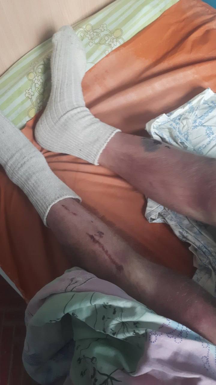 В Тараще Киевской области женщина нашла во дворе дома сестры своего сына, избитого до полусмерти и беспамятства (еще и галстуком душили) тцкшниками В Тараще Киевской области женщина нашла во дворе дома сестры своего сына, избитого до полусмерти и беспамятства (еще и галстуком душили) тцкшниками