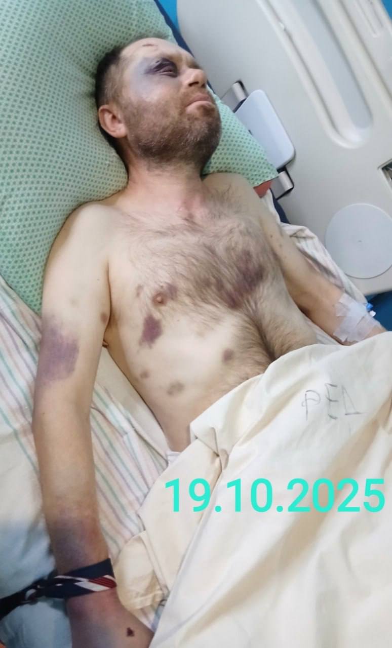В Тараще Киевской области женщина нашла во дворе дома сестры своего сына, избитого до полусмерти и беспамятства (еще и галстуком душили) тцкшниками В Тараще Киевской области женщина нашла во дворе дома сестры своего сына, избитого до полусмерти и беспамятства (еще и галстуком душили) тцкшниками