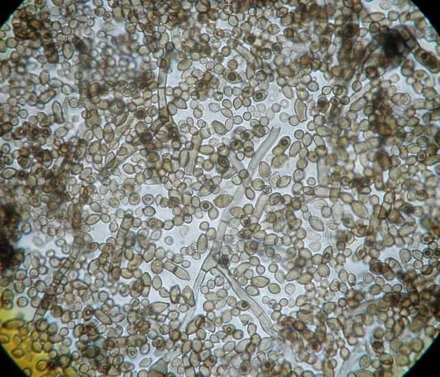 В Чернобыле растет гриб «питающийся» радиацией: В Чернобыле растет гриб «питающийся» радиацией: