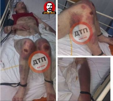 Несколько дней в ТЦК и реанимация