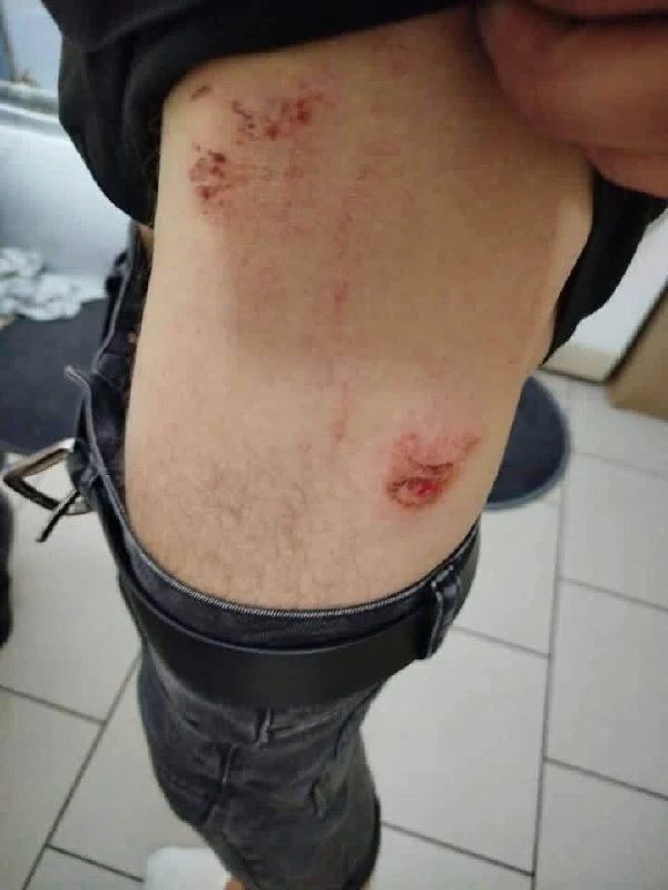 В Польше продолжают жестоко избивать украинцев В Польше продолжают жестоко избивать украинцев