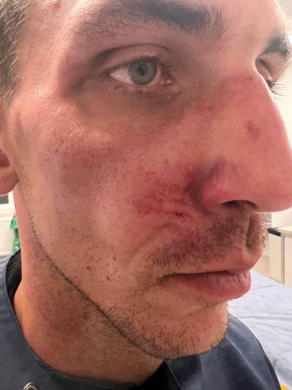 Польша продолжает встречать «братьев» по-своему Польша продолжает встречать «братьев» по-своему