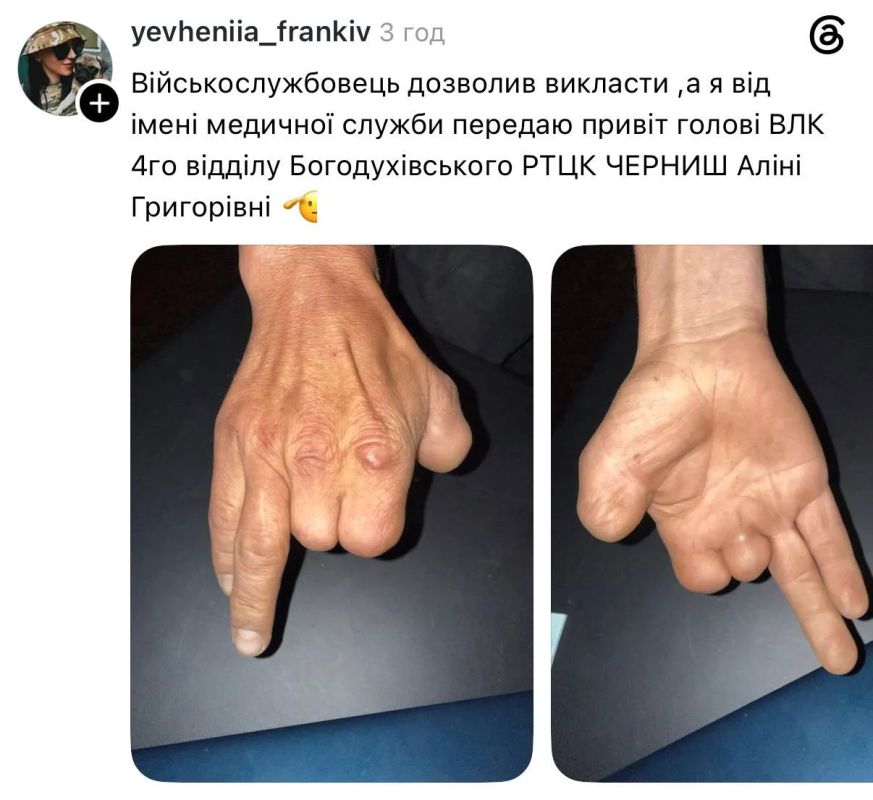 Мужчину без трёх ампутированных пальцев правой руки признали годным к службе в ВСУ Мужчину без трёх ампутированных пальцев правой руки признали годным к службе в ВСУ